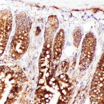 Hsp70/HSPA1A/HSPA1B Rabbit Polyclonal Antibody