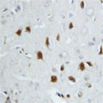 Hsp70/HSPA1A/HSPA1B Rabbit Polyclonal Antibody
