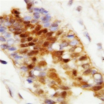 Hsp70/HSPA1A/HSPA1B Rabbit Polyclonal Antibody