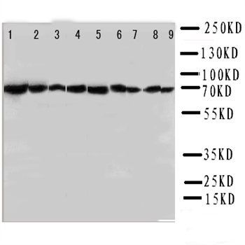 Hsp70/HSPA1A/HSPA1B Rabbit Polyclonal Antibody