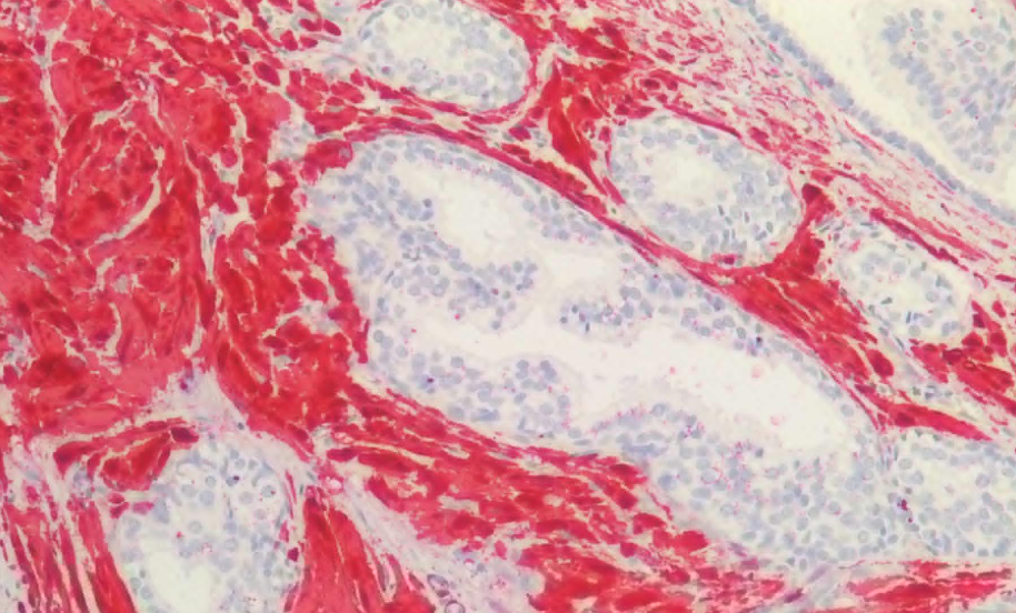 SM22 Alpha/Transgelin Antibody