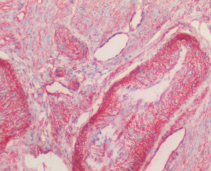 Caveolin 1 Antibody