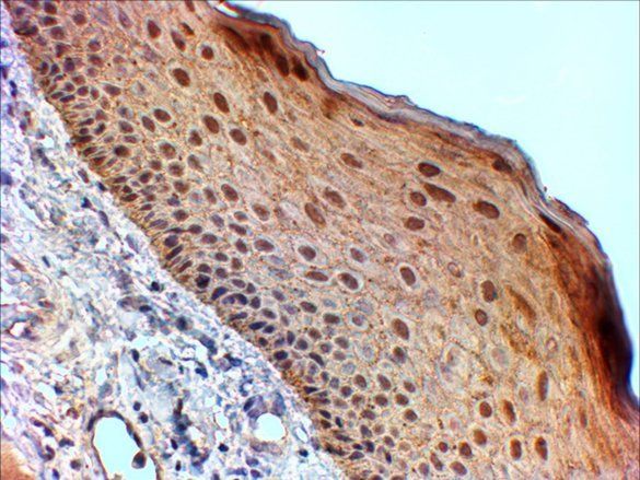 14-3-3 sigma/Stratifin Antibody