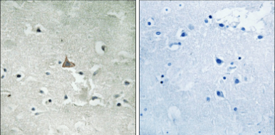 Trk B (Phospho-Tyr706/Tyr707) Rabbit Polyclonal Antibody