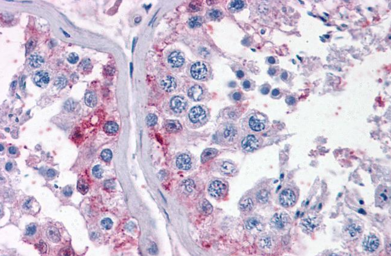 CYP26B1 Antibody