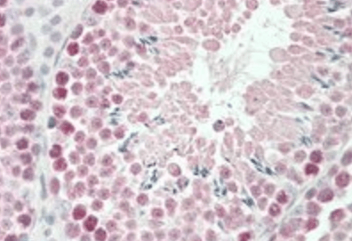 Robo1/DUTT1 (mouse) Antibody