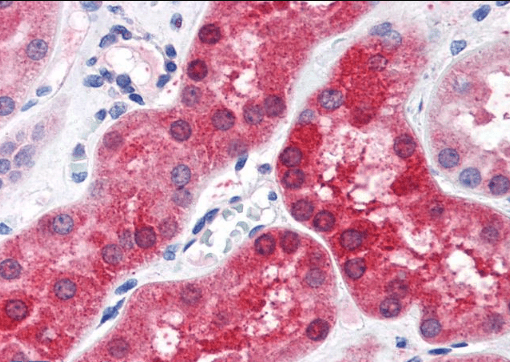 ABHD4 (aa 177 to 187) Antibody