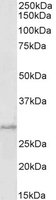 PRRX1 Antibody
