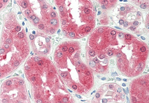 BDH2/DHRS6 (aa 60 to 71) Antibody