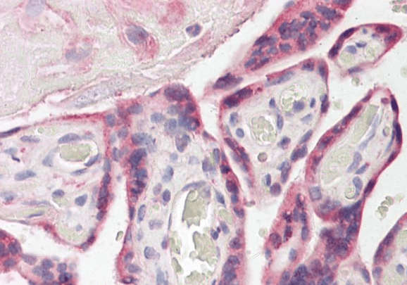 ESYT1 Antibody