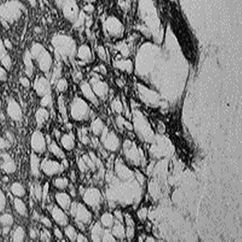 Goat anti-Proenkephalin (mouse) Antibody