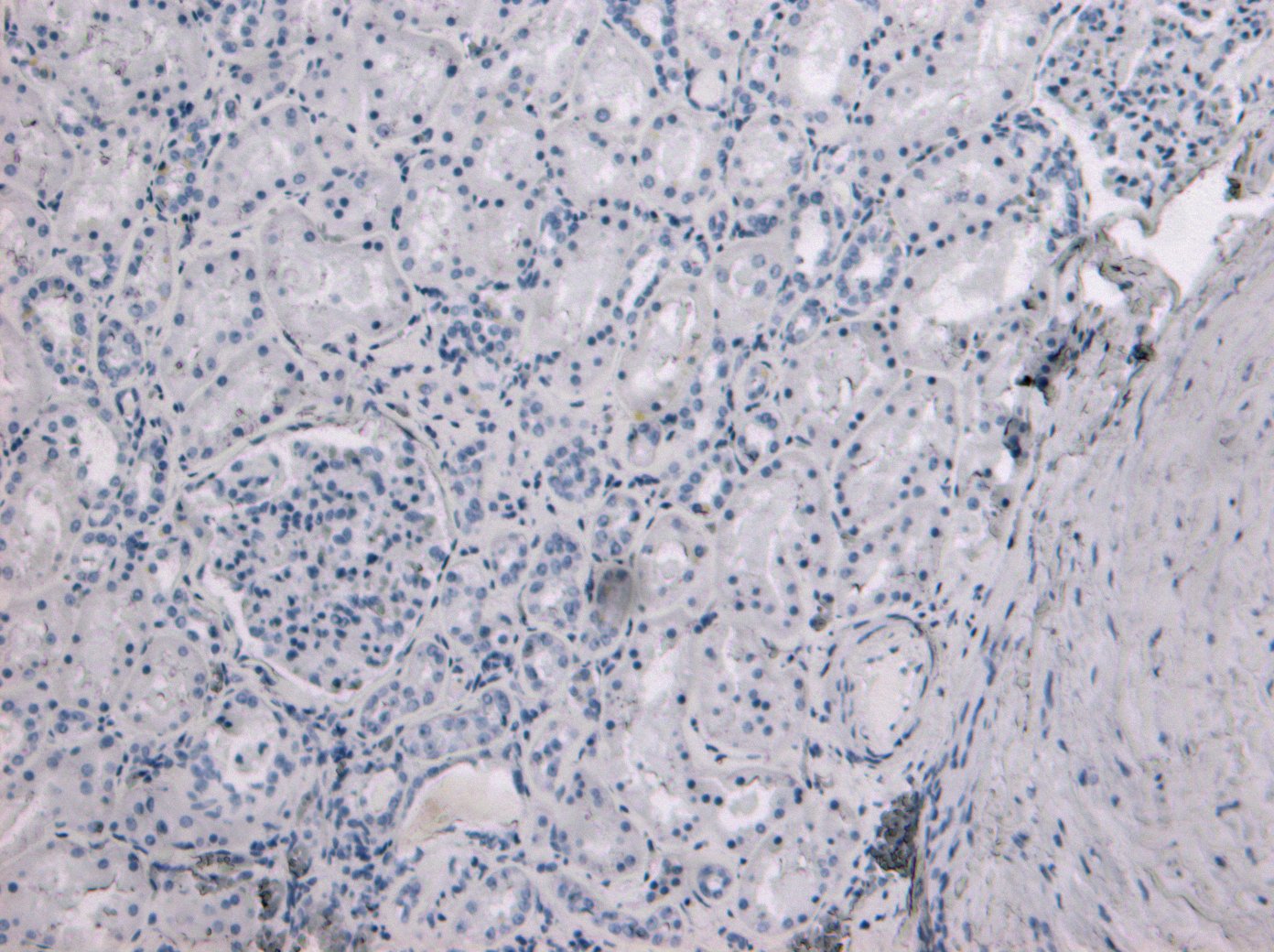 Goat anti-TMPRSS2 Antibody