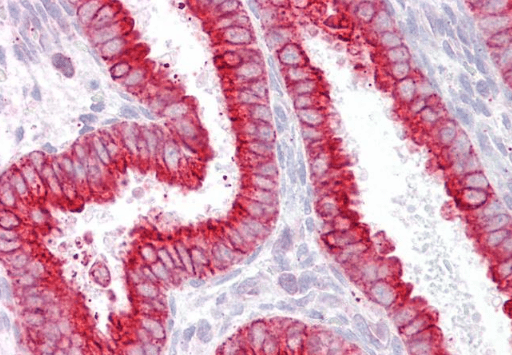 CHRNB2 Antibody