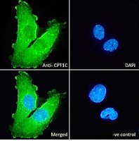 CPT1C Antibody