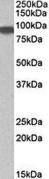 Aconitase 2 Antibody