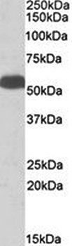 Glutamate Dehydrogenase Antibody