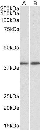 GNAQ/ALPHA-q (aa162-175) Antibody