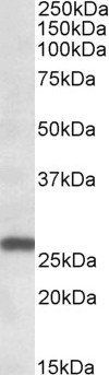 MOBKL3 (aa137-151) Antibody