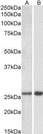 MOBKL3 (aa137-151) Antibody