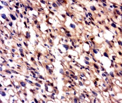 PLEKHM1 Rabbit Polyclonal Antibody