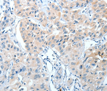 IL22RA1 Rabbit Polyclonal Antibody