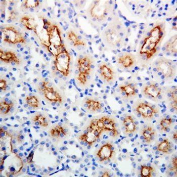 Connexin 32/GJB1 Rabbit Polyclonal Antibody