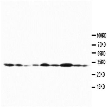 Connexin 32/GJB1 Rabbit Polyclonal Antibody