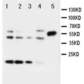 Stromelysin-2 MMP10 Rabbit Polyclonal Antibody