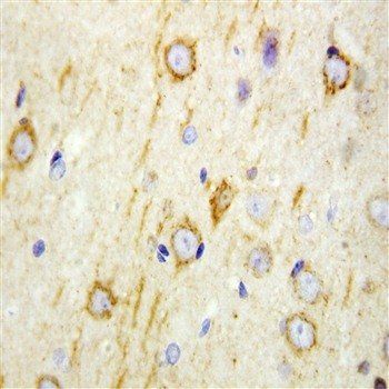 GAD65/GAD2 Rabbit Polyclonal Antibody