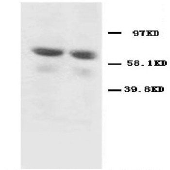 GAD65/GAD2 Rabbit Polyclonal Antibody