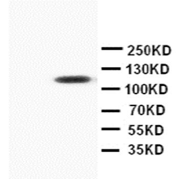 Progesterone Receptor/PGR Rabbit Polyclonal Antibody