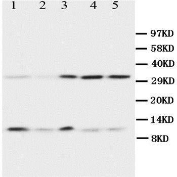 Ubiquitin/UBB Rabbit Polyclonal Antibody