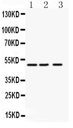 Angiopoietin-like 4/ANGPTL4 Rabbit Polyclonal Antibody
