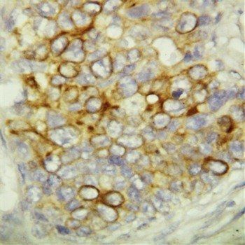 Caspase-6/CASP6 Rabbit Polyclonal Antibody