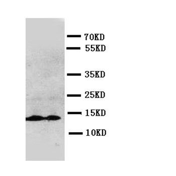 Interleukin-13 IL13/13 Rabbit Polyclonal Antibody