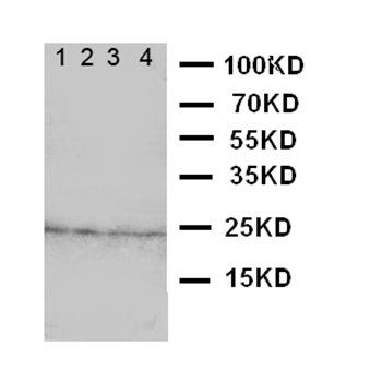 Fibroblast growth factor 22 FGF22 Rabbit Polyclonal Antibody