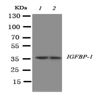 IGFBP1 Rabbit Polyclonal Antibody