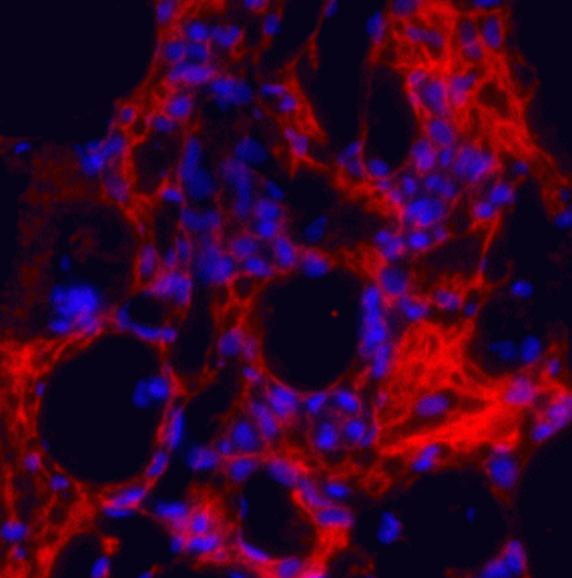 Anti-Collagen 1, alpha 1 telopeptide Antibody