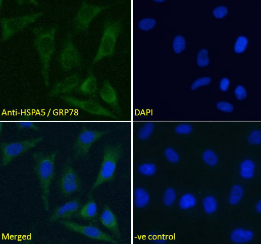 HSPA5/GRP78 Antibody