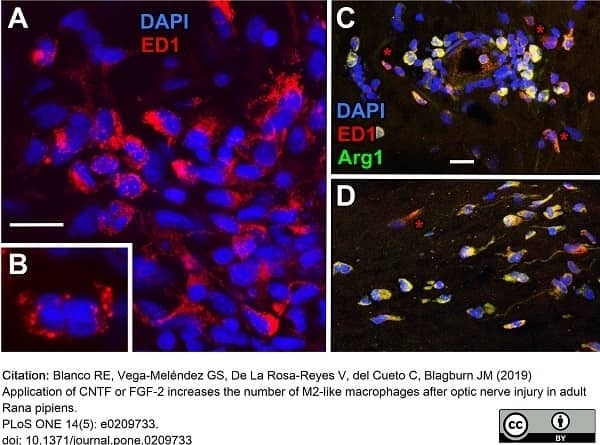 CD68 Antibody (RPE)