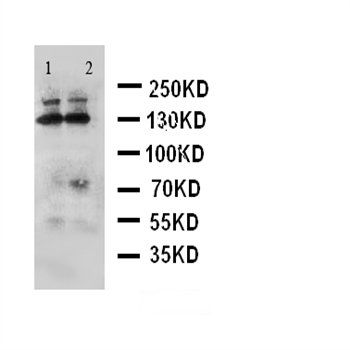 ADAMTS4/ADAMTS4 Rabbit Polyclonal Antibody