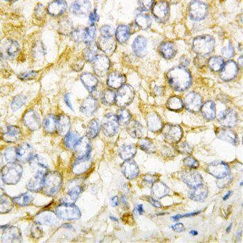 AIMP2/p38 Rabbit Polyclonal Antibody