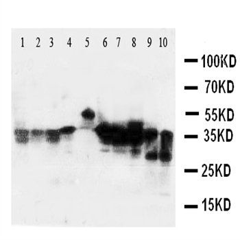 AIMP2/p38 Rabbit Polyclonal Antibody