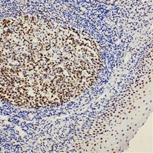 BOB1/POU2AF1 Rabbit Polyclonal Antibody