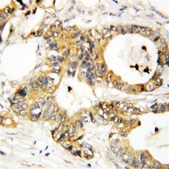 Annexin A3/ANXA3 Rabbit Polyclonal Antibody