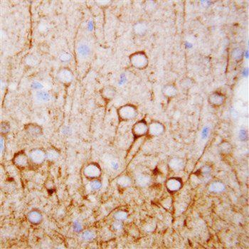 CaMKK/CAMKK1 Rabbit Polyclonal Antibody