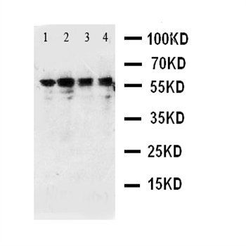 CaMKK/CAMKK1 Rabbit Polyclonal Antibody
