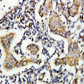 Caspase-8/CASP8 Rabbit Polyclonal Antibody