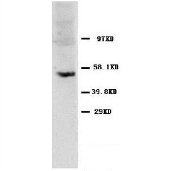 Caspase-8/CASP8 Rabbit Polyclonal Antibody