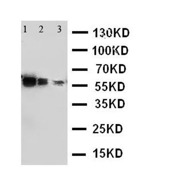ADAM10/ADAM10 Rabbit Polyclonal Antibody